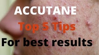 Accutane 5 tips by Dermatologists [upl. by Ahsirtal867]