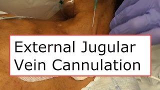 External Jugular Vein Cannulation [upl. by Gebhardt]