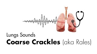 Lung Apices Medical Definition  Quick Explainer Video [upl. by Lacy]