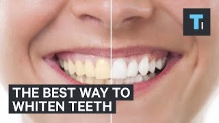 The best way to whiten teeth [upl. by Conner]