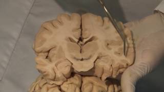 Cortical Localization Neuroanatomy Video Lab  Brain Dissections [upl. by Husein559]