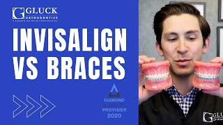 Invisalign Cost and Effectiveness [upl. by Kilah]