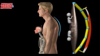 Myofacia approach for forwardhead posture [upl. by Htinnek]