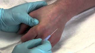 Intravenous Catheter Placement [upl. by Viviane864]