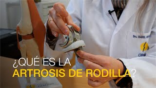 ¿Qué es la artrosis de rodilla [upl. by Andris]