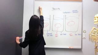 Abnormal Gait Exam  Diplegic Gait Demonstration [upl. by Imhskal594]