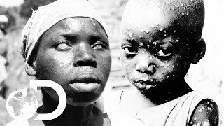 The Eradication Of Smallpox  Invisible Killers [upl. by Airan]