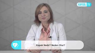 Kepek Nedir Neden Olur [upl. by Nnayd439]