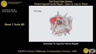 Overview inguinal hernia repair [upl. by Yrellam]