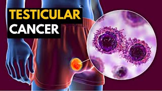 Testicular Cancer Causes Signs and Symptoms Diagnosis and Treatment [upl. by Jammie]