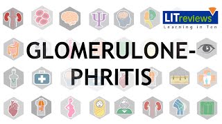 Glomerulonephritis [upl. by Anidam]