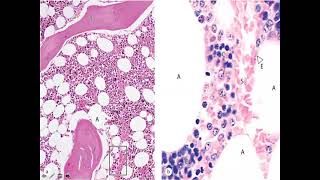 Bone Marrow and Hematopoiesis Histology [upl. by Fai972]