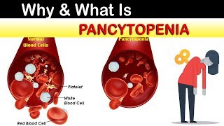 Why amp What Is Pancytopenia [upl. by Maximo13]