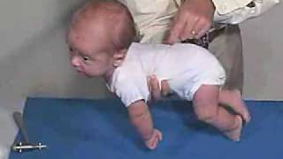 Neurology Exam 3 Month Primitive ReflexesGalant [upl. by Weeks]