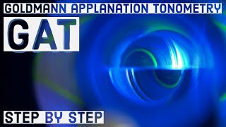 Goldmann applanation Tonometry GAT  basic STEP BY STEP GUIDE [upl. by Llemrej]