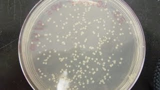 CFU Colony Forming Unit amp cfuml calculation [upl. by Annoyek]