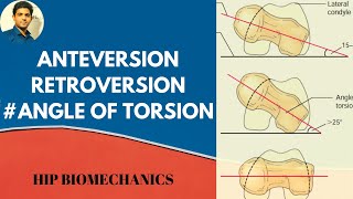 Anterversionamp Retroversion Angle of torsionhip biomechanics [upl. by Drusi]