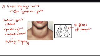 Simple Goitre  Thyroid [upl. by Philemon]