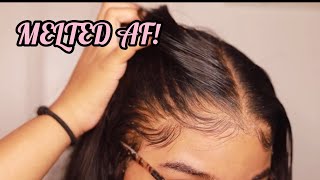 How to RE Install Frontal Wigs for Beginners  VERY DETAILED  Melt Transparent Lace [upl. by Gottlieb]