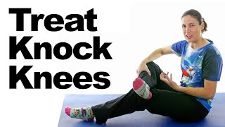 Fixing Your Knock Knees With Two Exercises [upl. by Alick]