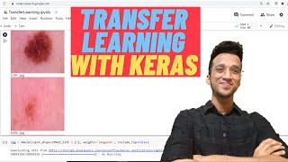 Transfer Learning Using CNNVGG 16 Keras Tutorial [upl. by Sauer948]