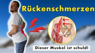 Rückenschmerzen sind kein Bandscheibenvorfall  Ursache amp Lösung durch Übungen [upl. by Sadella]