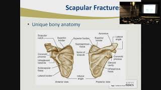 Lateral Clavicle  Dislocations and Fractures  The LCP Clavicle Hook Plate [upl. by Notsae]