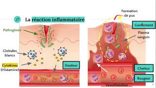 La réaction inflammatoire 🔥 [upl. by Ecarg330]