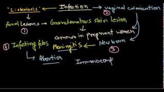 Listeria monocytogenes infection [upl. by Balliett22]