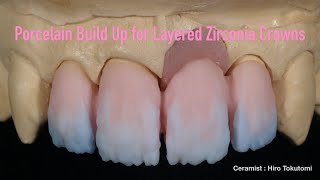 Porcelain Build Up for Layered Zirconia Crowns [upl. by Willing]