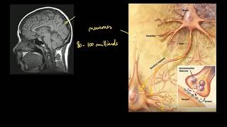 Comment développer son cerveau [upl. by Ainod]