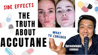 ACCUTANE  Dermatologist Review Unbiased [upl. by Elleirol]