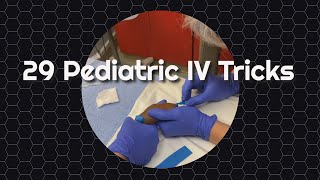 29 Pediatric IV Tricks [upl. by Idalla]