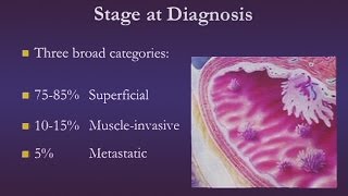 Bladder Cancer [upl. by Bodrogi]