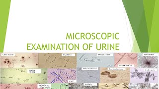 Microscopic Examination of Urine [upl. by Gibeon]