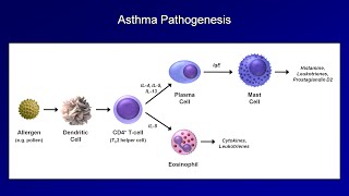 Asthma and COPD  Pathogenesis and Pathophysiology [upl. by Dehlia]