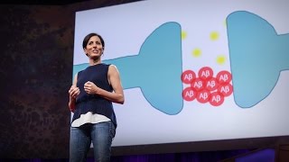 What You Can Do to Prevent Alzheimers  Lisa Genova  TED [upl. by Eppie]