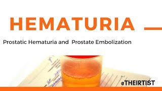 Hematuria Causes amp Diagnostic Workup of Blood in Urine [upl. by Lemrej771]