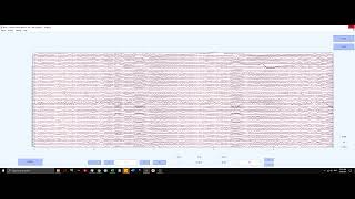 PreProcessing EEG data using EEGLAB GUI [upl. by Anahsal509]