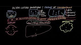 Acidocétose diabétique  Famine de Surabondance  Partie 1  Docteur Synapse [upl. by Arlene]