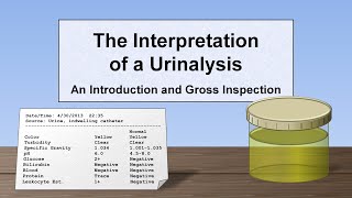 Interpretation of the Urinalysis Part 1  Introduction and Inspection [upl. by Rondon]