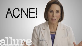 What is Acne and How Do I Get Rid of it Forever  Allure [upl. by Macnamara]