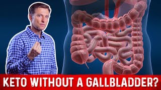 Can I do a Ketogenic Diet Without a Gallbladder – Dr Berg on Keto Diet Without Gallbladder [upl. by Nylrebma]