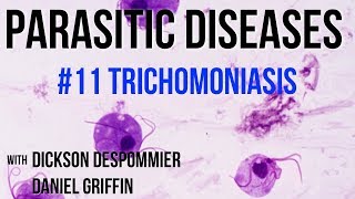 Parasitic Diseases Lectures 11 Trichomoniasis [upl. by Ribaj]