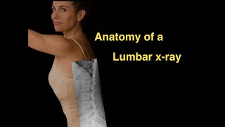 Anatomy of a Lumbar xray [upl. by Aimahc374]