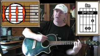 Comfortably Numb  Pink Floyd  Acoustic Guitar Lesson [upl. by Hahcim]